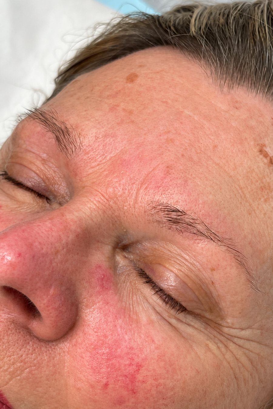 Microblading, before treatment